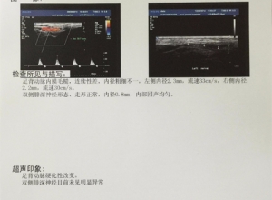 醫(yī)用膠片具備哪些應用特點？
